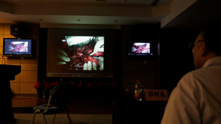 Study Says Over 400 Organ Transplant Studies Using Chinese Data Should Be Retracted Over Ethical Concerns